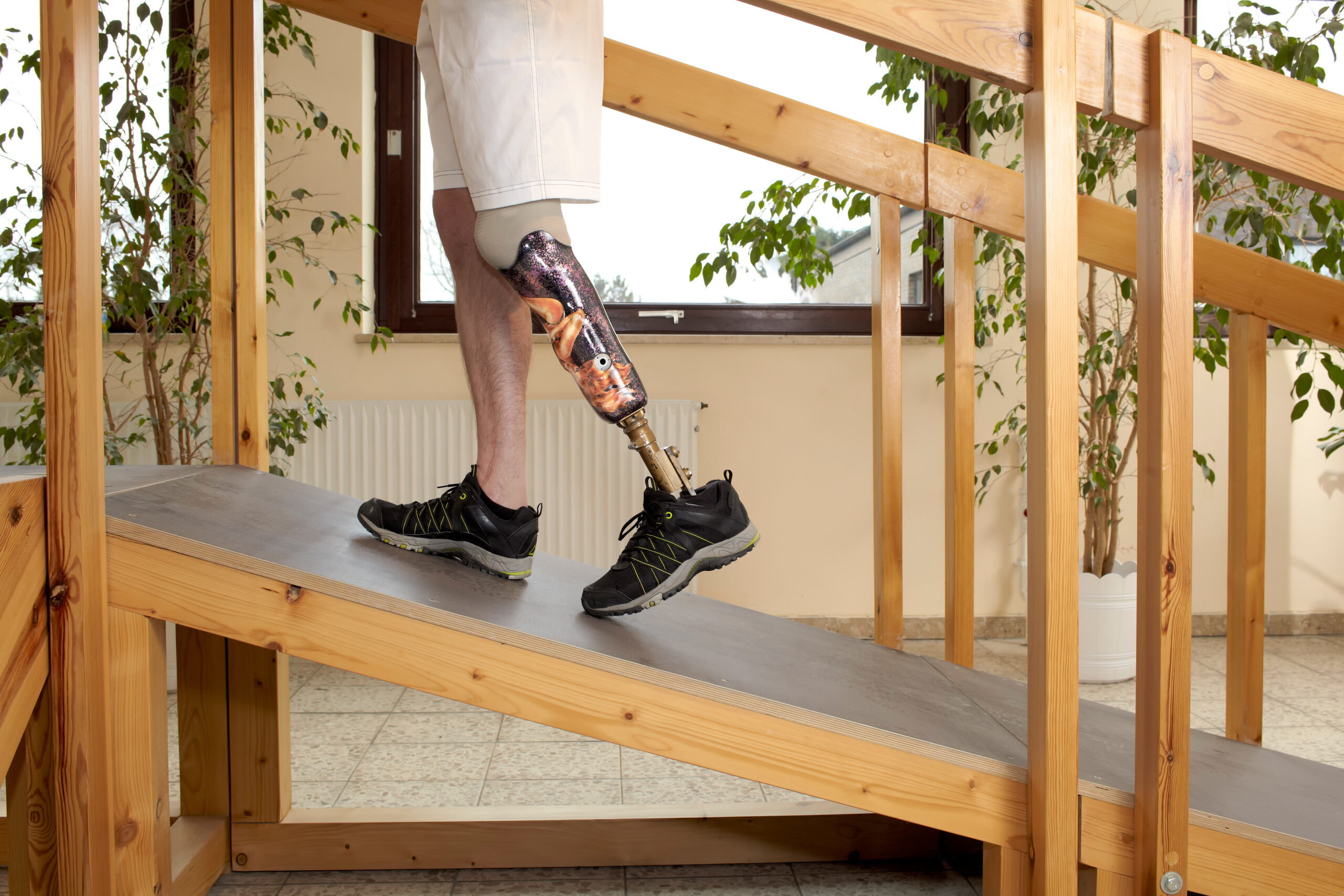 A male prosthesis wearer in a training situation. Male prosthesis wearer training to climb a slope unaided in a speical parcour or interior area where surfaces have been laid out to simulate realistic environmental situations