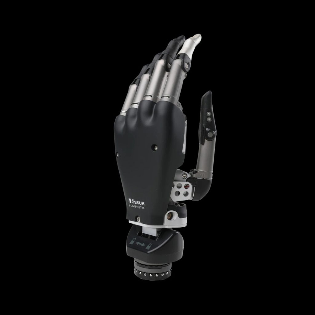 Advancements in Prosthetic Technology: Top 5 Prosthetic Hands on the Market image