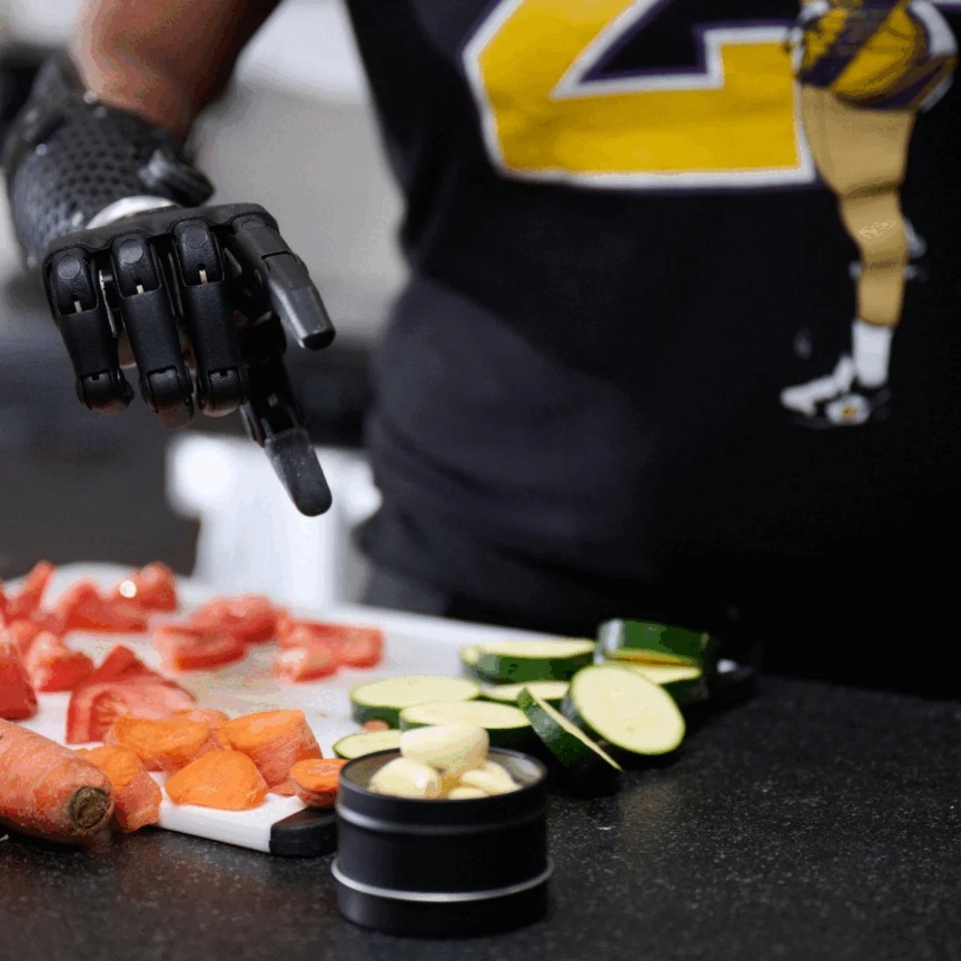 Hero Arm by Open Bionics: A Revolutionary Prosthetic Solution 20250717 122952