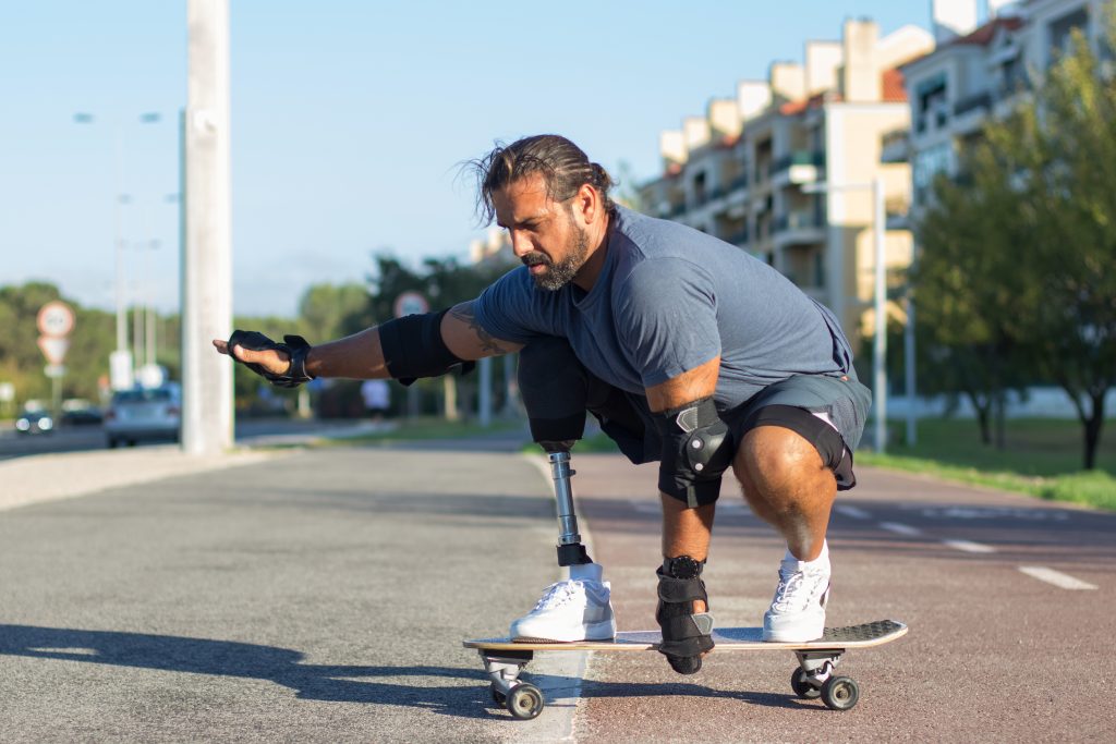 Living Fully With Limb Loss: Redefining What’s Possible attractive person with disability doing sports in park